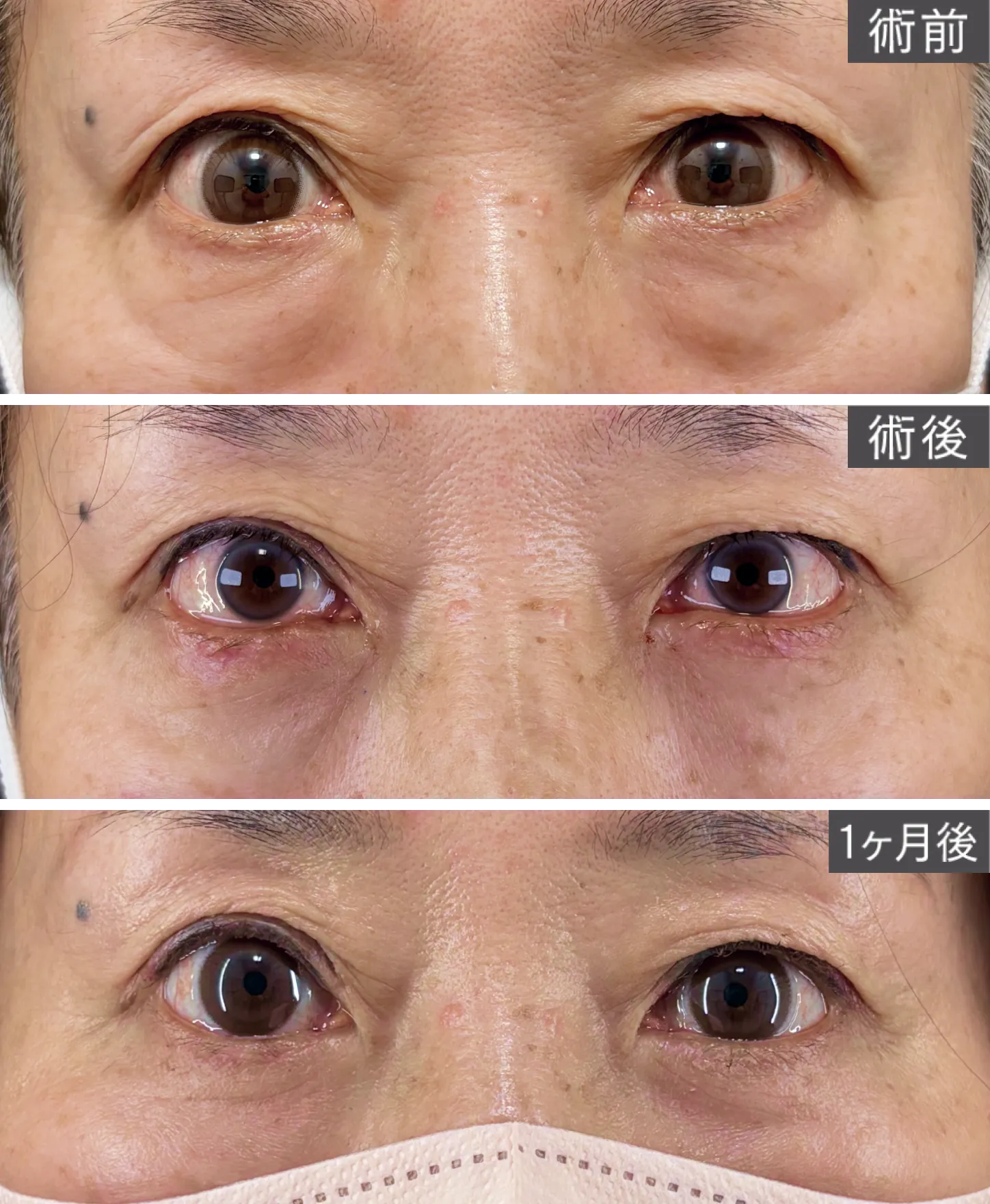 ビフォアーアフター