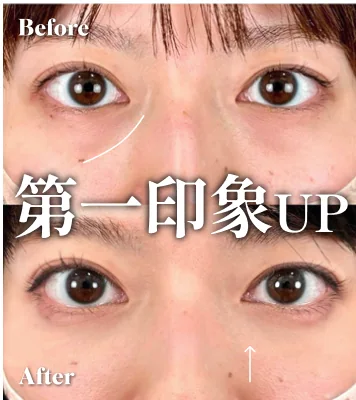 症例写真 第一印象UP