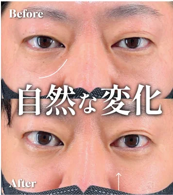 症例写真 自然な変化