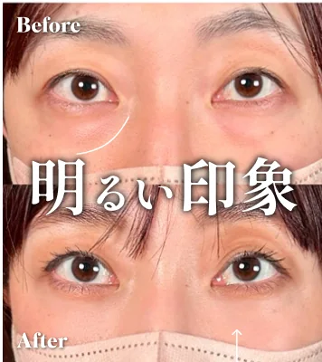 症例写真 明るい印象