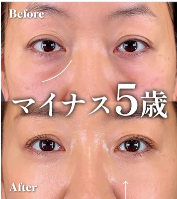 症例写真 マイナス5歳
