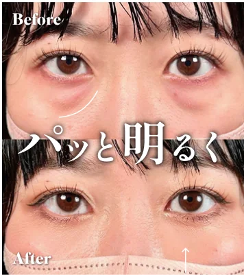 症例写真 パッと明るく