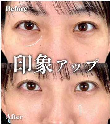 症例写真 印象アップ