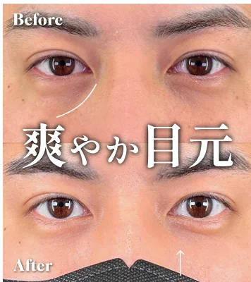 症例写真 爽やか目元